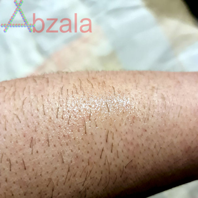 ahmed al maghribi frost ice 011 thumbs